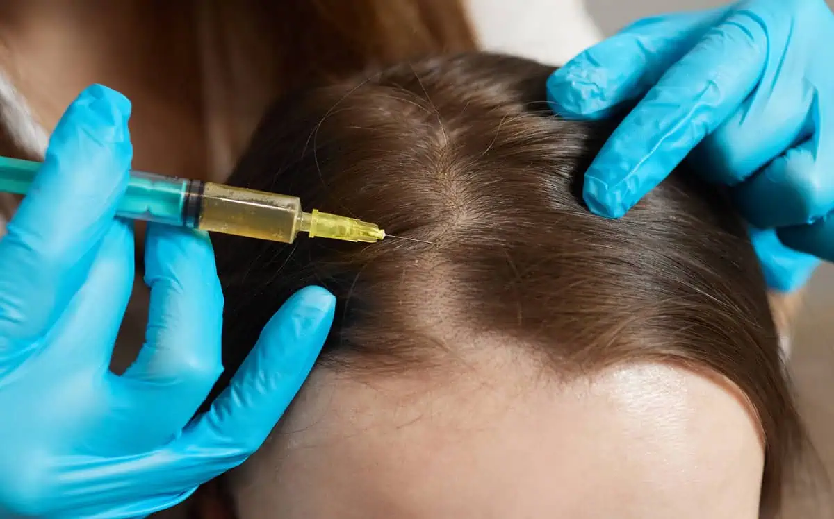 Is PRP Hair Restoration the Right Treatment for Hair Loss? A Detailed Guide