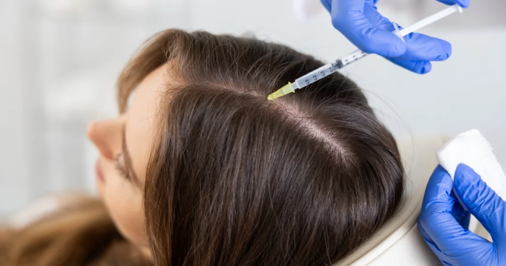 Woman receiving scalp injection for hair restoration treatment in Plantation, FL