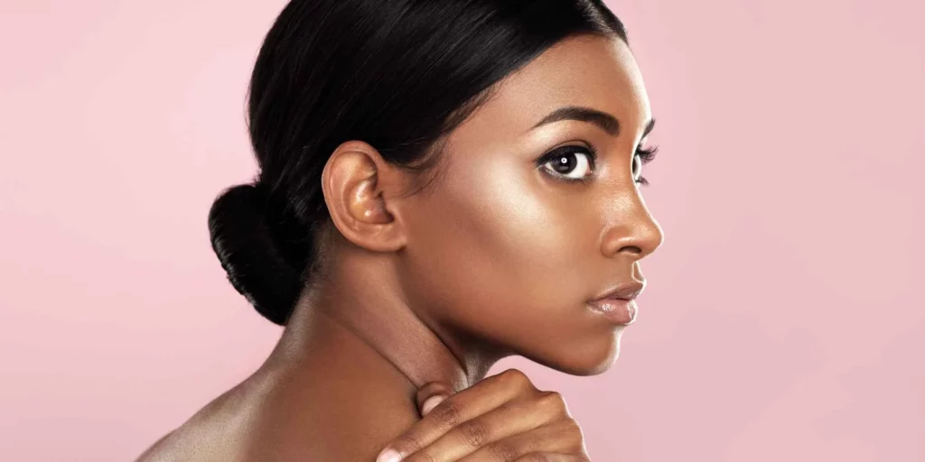 Acne in Plantation FL by Maven Aesthetics